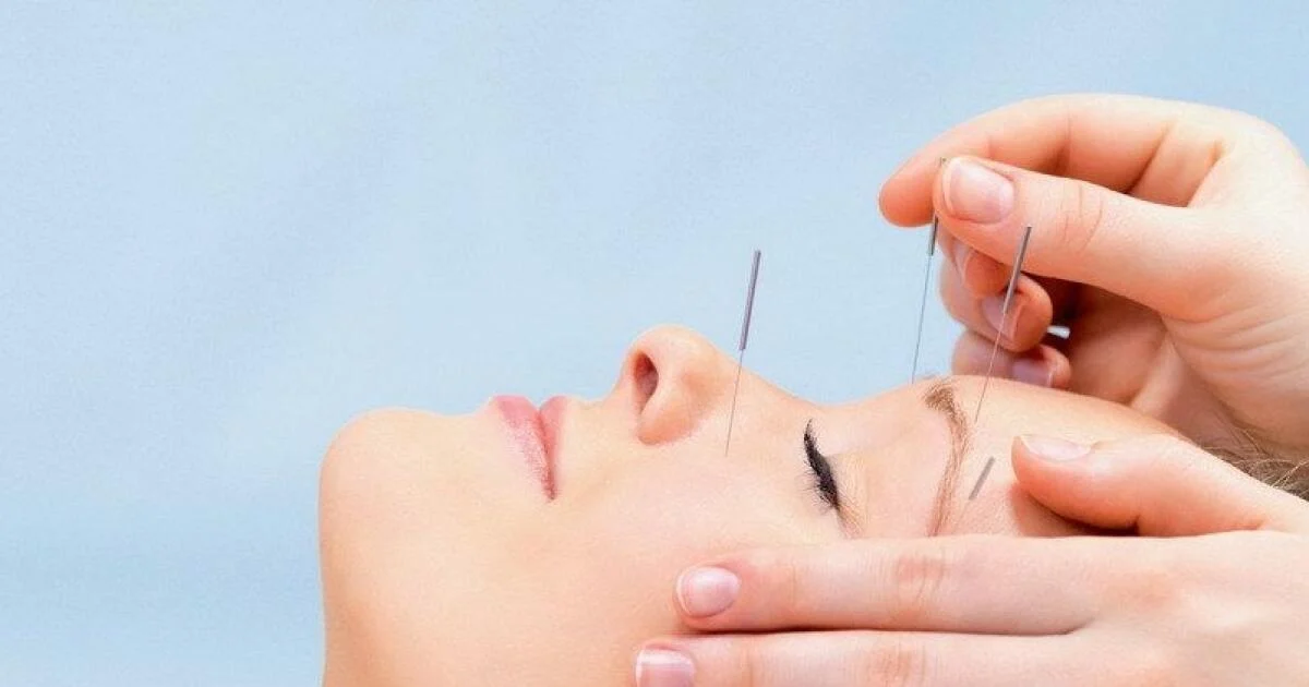 What Are The Pros And Cons Of Dry Needling