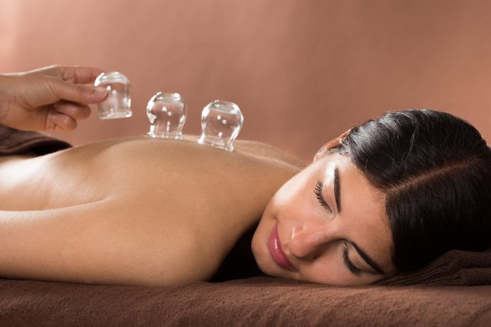 cupping therapy Melbourne