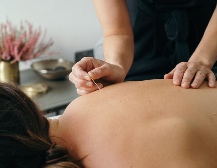 Trigger Point Therapy Melbourne