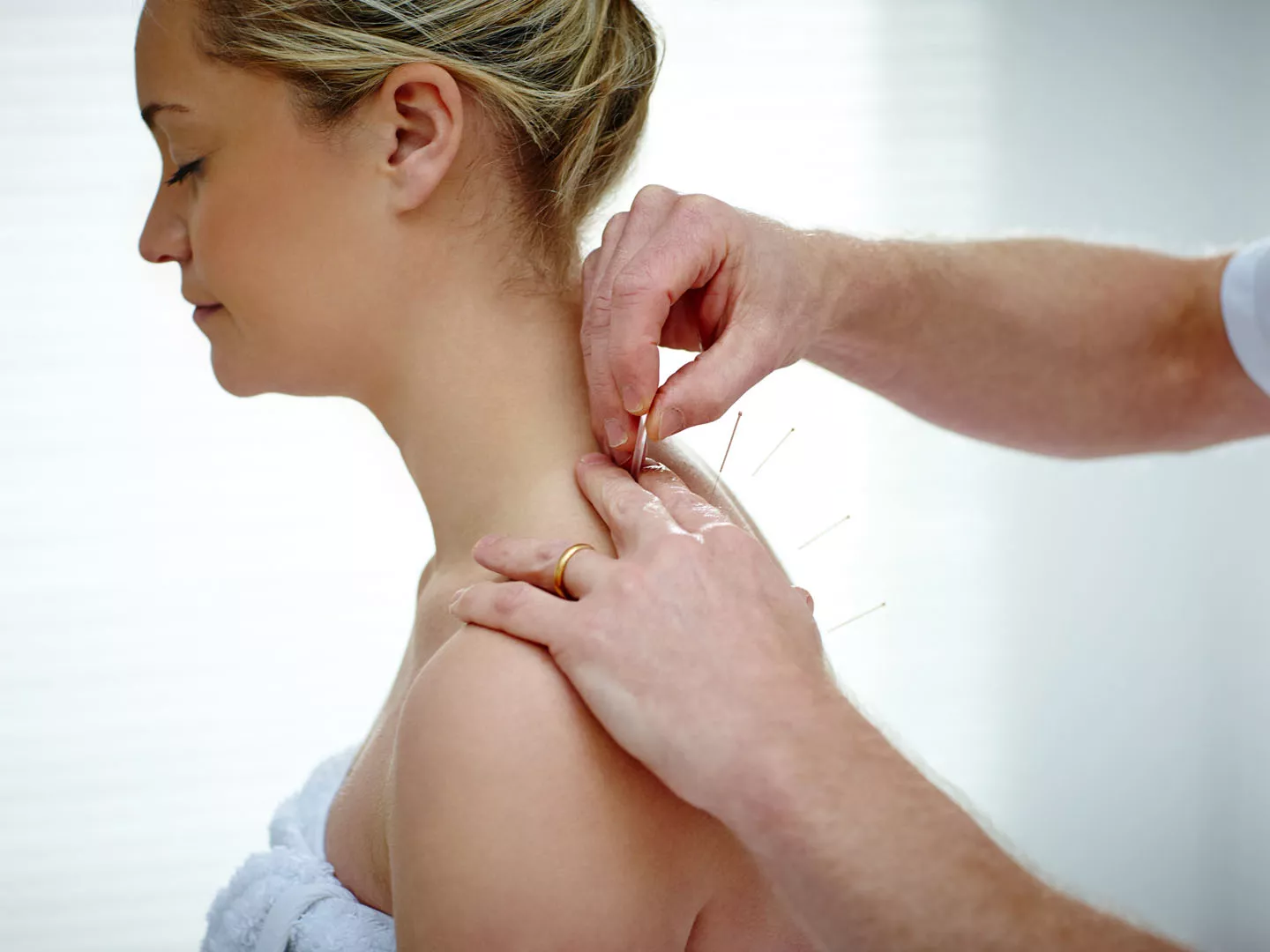 Dry needling physio Melbourne