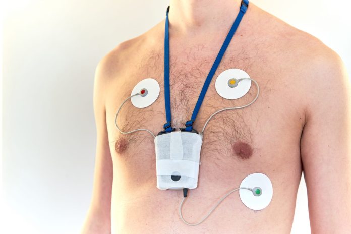 holter monitor test Sydney