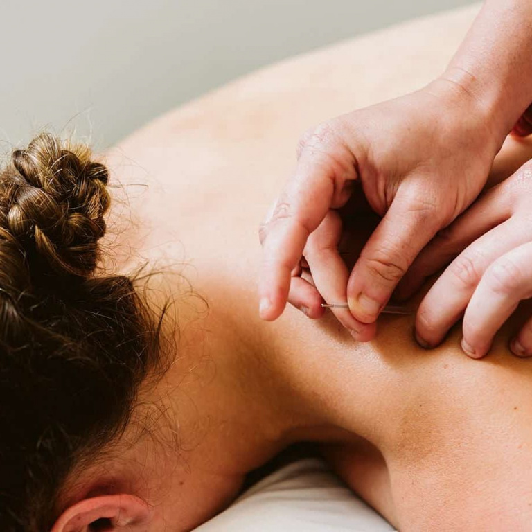 Trigger-Point-Therapy-Melbourne-